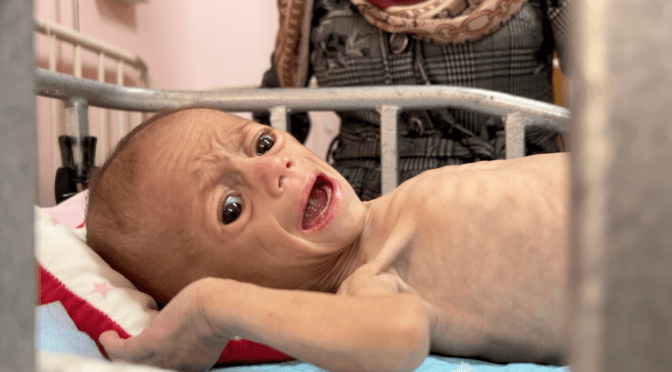 Why are these Christians denying that children are starving in Gaza?